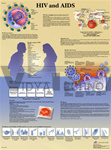 HIV and AIDS - Anatomical Chart